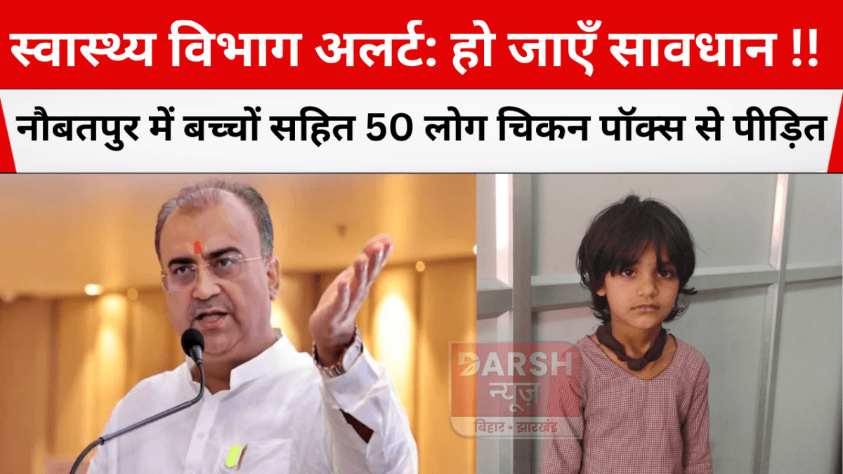 स्वास्थ्य विभाग अलर्ट: हो जाएँ सावधान !! नौबतपुर में बच्चों सहित 50 लोग चिकन पॉक्स से पीड़ित